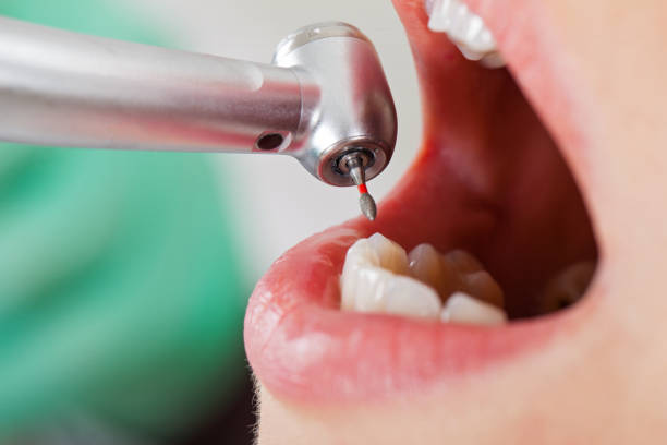 Best Emergency Gum Treatment in Siler City, NC
